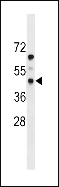 PDGFRL Antibody