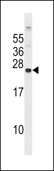 GPX8 Antibody