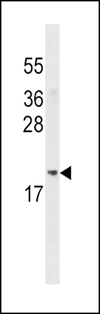 ADI1 Antibody