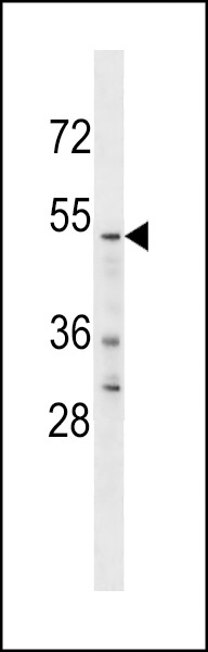 YTHDF2 Antibody