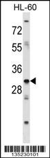 HOXB9 Antibody