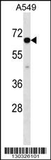 CLPTM1L Antibody