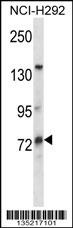 MUM1L1 Antibody