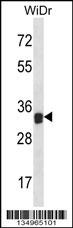 LGALS9 Antibody