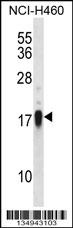 CD70 Antibody
