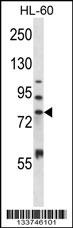 MMP15 Antibody