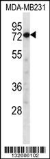 CAPN8 Antibody