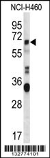 ERVFRD-1 Antibody