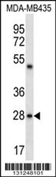 CDRT15L2 Antibody