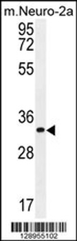 ZC3H8 Antibody