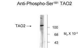 TAOK2 Antibody