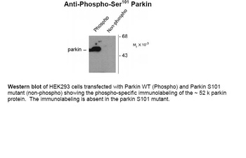 PARK2 Antibody