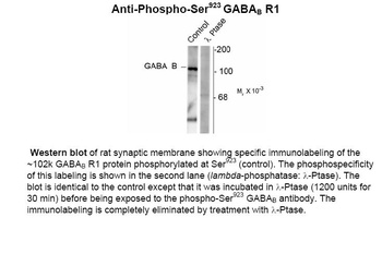 Gabbr1 Antibody