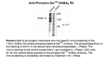 Gabbr2 Antibody