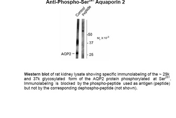 Aqp2 Antibody