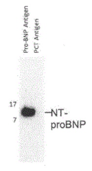NPPB Antibody