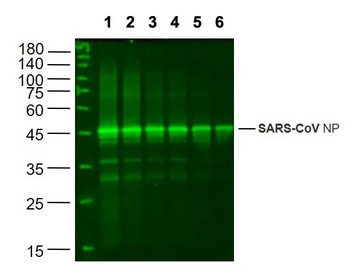 SARS Nucleocapsid Antibody