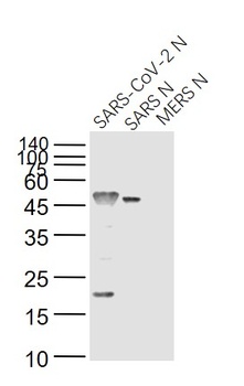 SARS Nucleocapsid Antibody [7C2B]