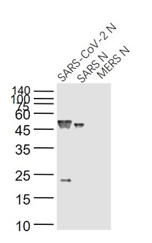 SARS Nucleocapsid Antibody [14B3D]