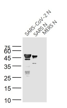 SARS Nucleocapsid Antibody [5C6C]