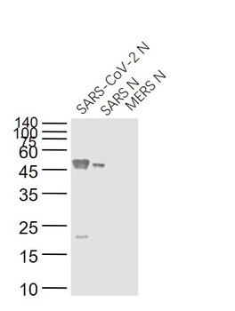SARS Nucleocapsid Antibody [5B1B]