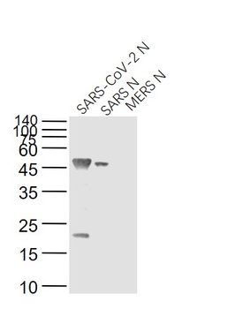 SARS Nucleocapsid Antibody [8G8A]