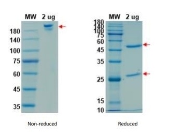 Recombinant SARS-CoV-2 (COVID-19) (S1) -2 Antibody [CR3022]