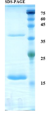 Interleukin 2 Recombinant Protein