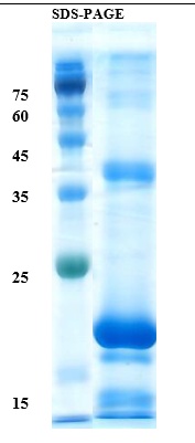 Interleukin 17A Recombinant Protein