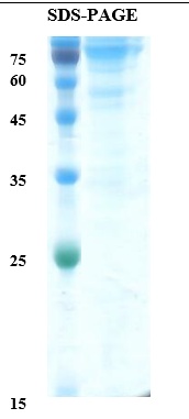 Anti-Müllerian Hormone (AMH) human Recombinant Protein