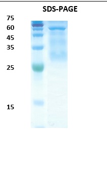Plasmodium falciparum histidine-rich 2 (Pf-HRP II) Recombinant Protein