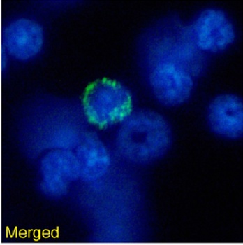 MHC I Antibody [R1-21.2], Rabbit IgG