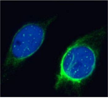 Membrane type 1 metalloprotease Antibody [LEM-2/15], Mouse IgG1