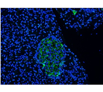 carcinoembryonic antigen (CEA) Antibody [Arcitumomab], Human IgG1 - Research Grade Biosimilar