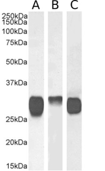 HLA class II Antibody [F3.3], Rabbit IgG