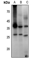 Aquaporin 2 (pS256) antibody