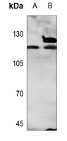 Androgen Receptor antibody