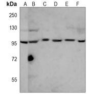 RANBP9 antibody