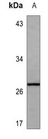 GDF11 antibody