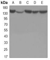Histone Deacetylase 4 antibody