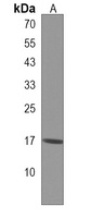 Anti-RPL29 Antibody