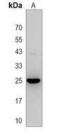 Anti-MOSPD3 Antibody
