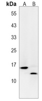 Anti-FAU Antibody