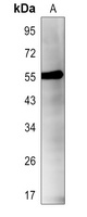 Anti-RIPK3 (Phospho-S227) Antibody