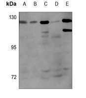 Androgen Receptor (phospho-S650) antibody