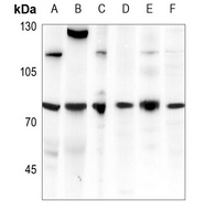 CDC25C antibody
