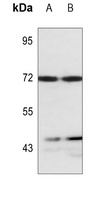 LIMK1; LIMK2 antibody