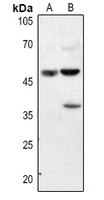 Annexin A7 antibody