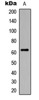 CHK2 (phospho-S516) antibody