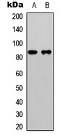 beta-catenin (phospho-S33) antibody